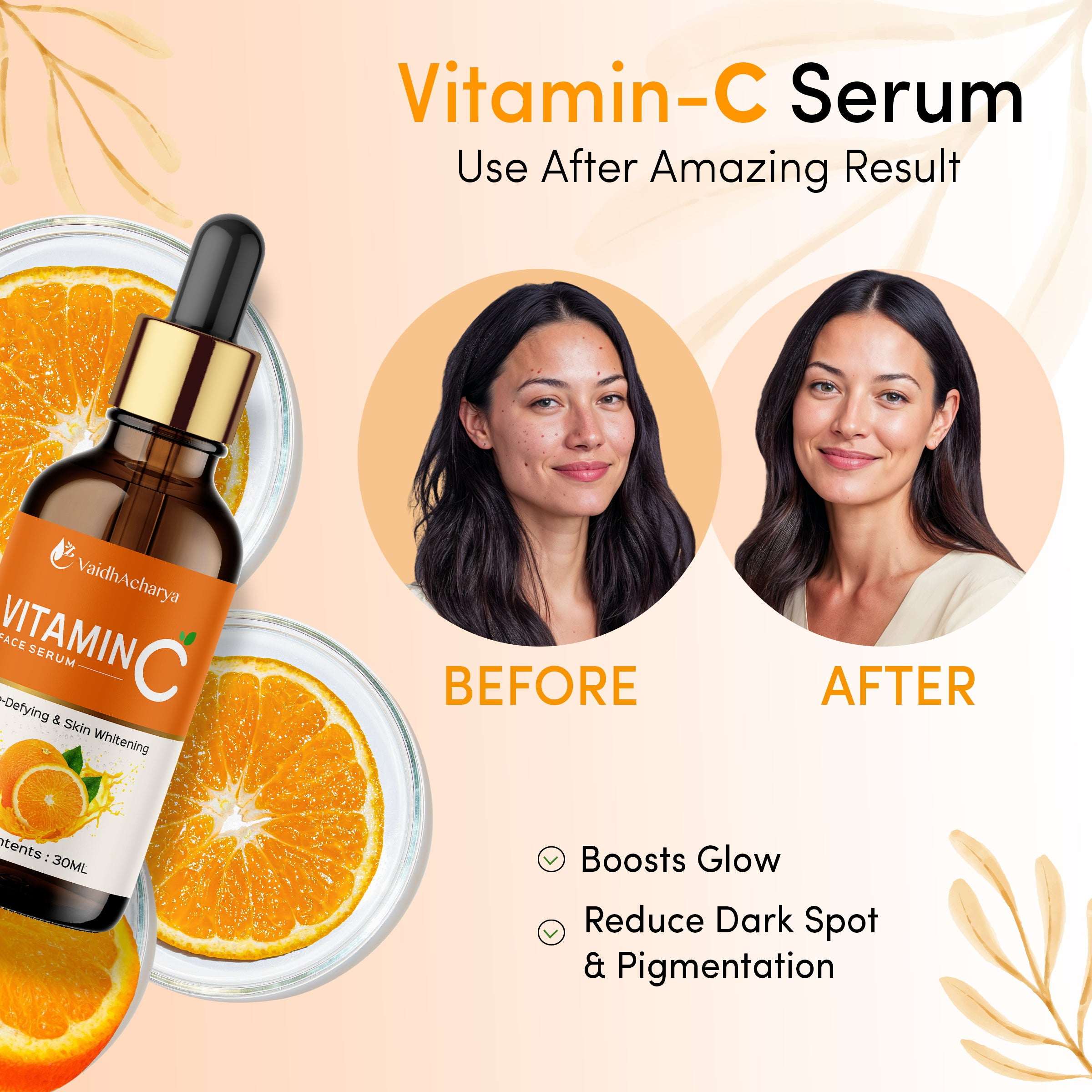 Vitamin C Serum | Reduces Dark Spots, Pigmentation & Oily Skin