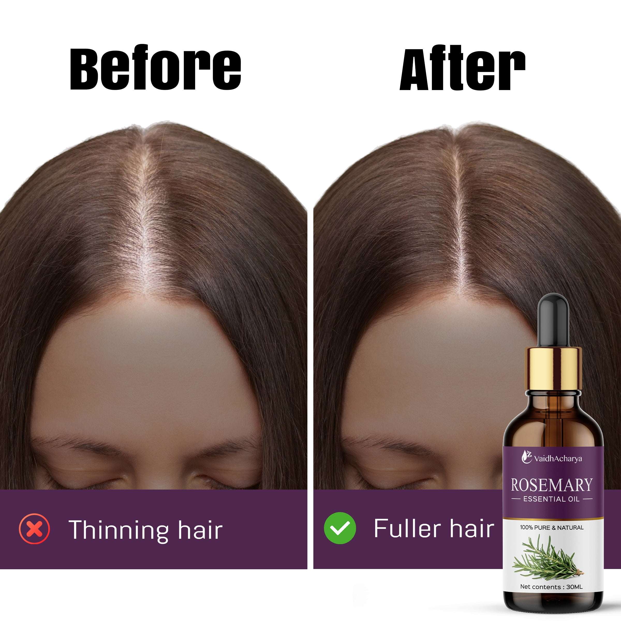 Rosemary Essential Oil For Hair Growth For Women & Men