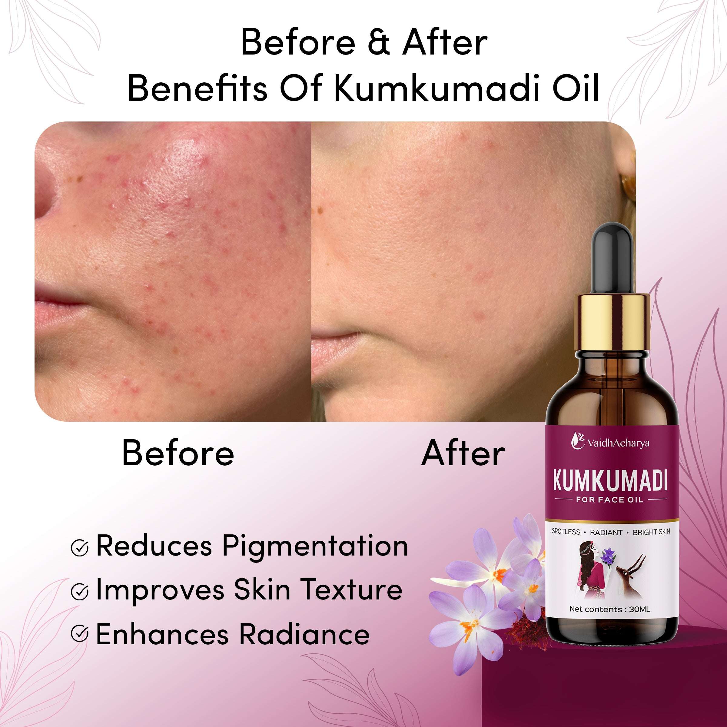 Kumkumadi Face Oil For Glowing Skin, Whitening, Lightening & Pigmentation