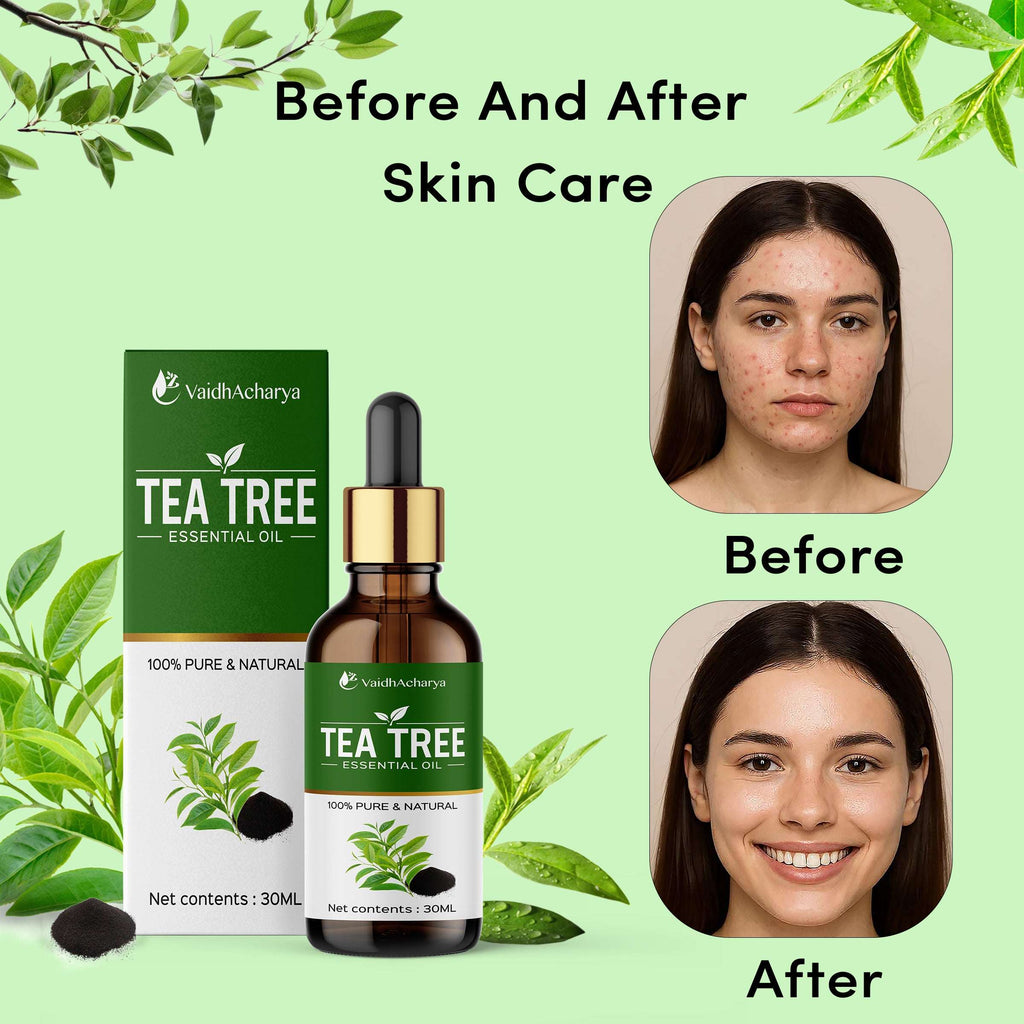 Tea Tree Essential Oil for Hair, Skin, Dandruff, Acne Care