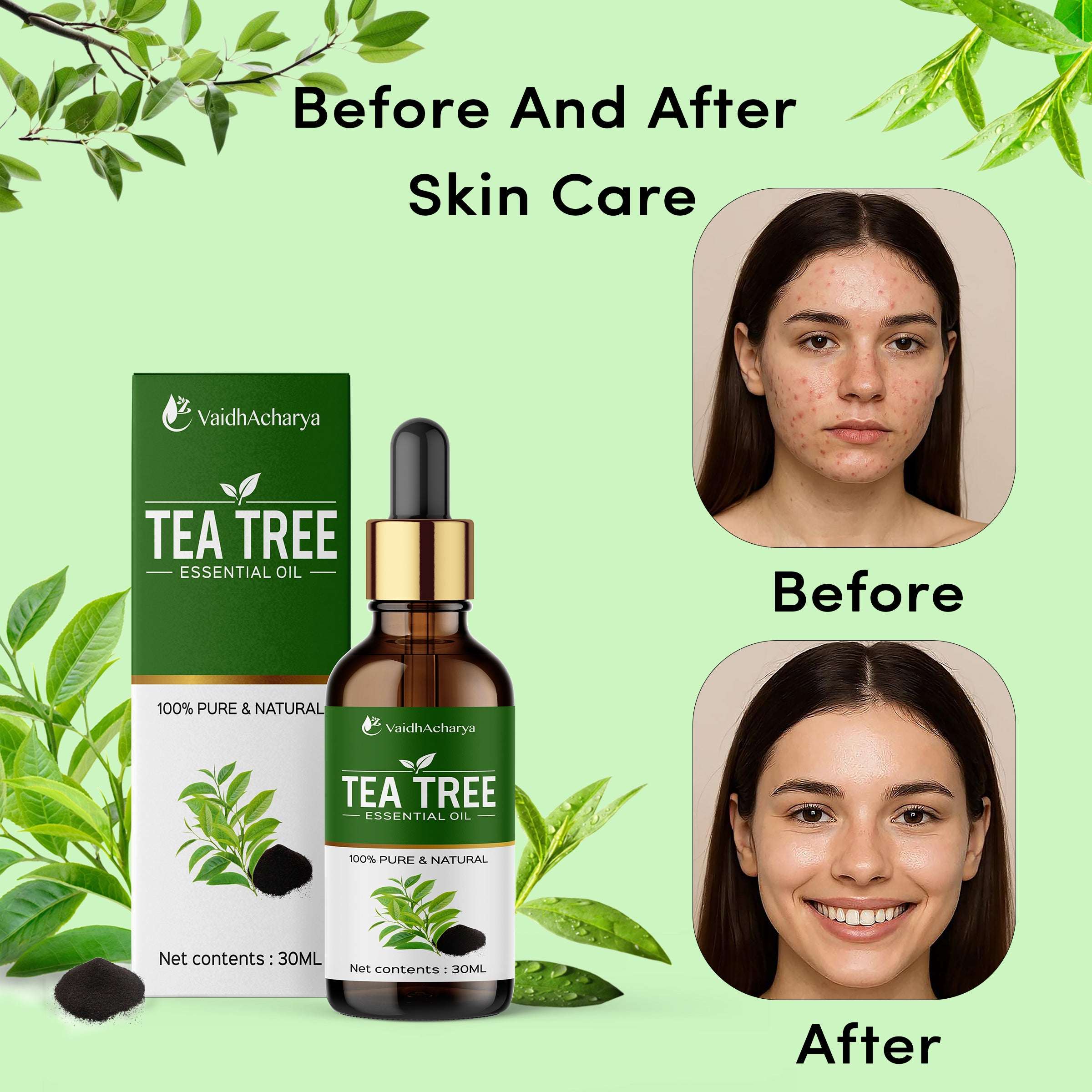 Tea Tree Essential Oil for Hair, Skin, Dandruff, Acne Care